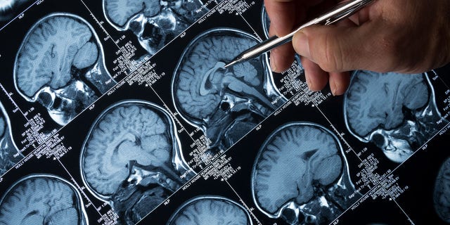 How my faith was strengthened in an MRI tube 3 Brain MRI of the head and skull