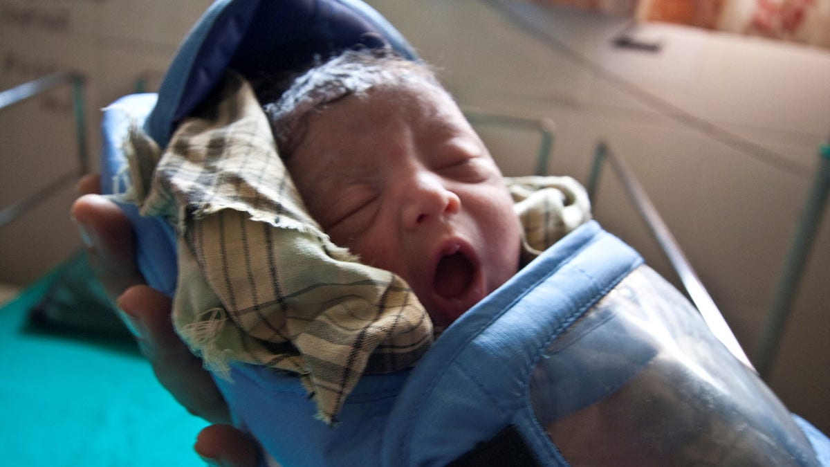 babies incubators Ukraine