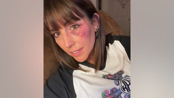 Mississippi youth softball umpire says she was punched in face by angry mom after game: report