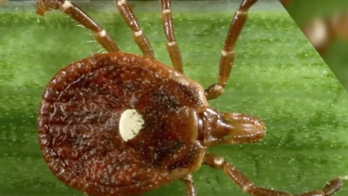 Connecticut reports year’s first fatality, second case of Powassan virus due to tick bite