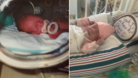 First-time mom, born a preemie herself, welcomes own micro-preemie daughter: 'Full circle story'