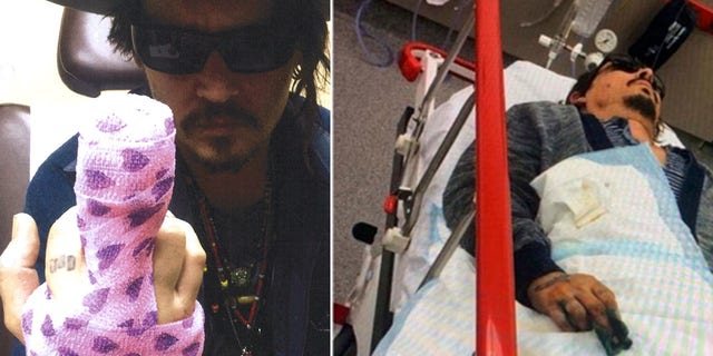 A combination of evidence photos showing Johnny Depp with a cast on his finger he says was severed by Amber Heard during a brawl in 2015. The photo on the right shows the actor in a hospital bed with an alleged cigarette burn on his cheek getting treatment for his injured finger.