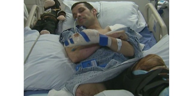 Boston Marathon bombing survivor Marc Fucarile rests in a hospital bed after the second bomb detonated in his path in 2013. (Marc Fucarile)