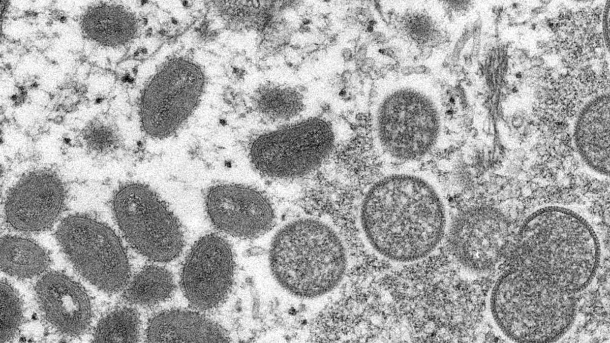Electron microscope image of the monkeypox virus