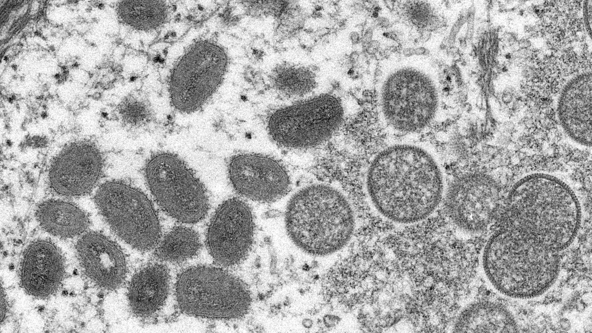 Monkeypox virus in an electron microscopic image