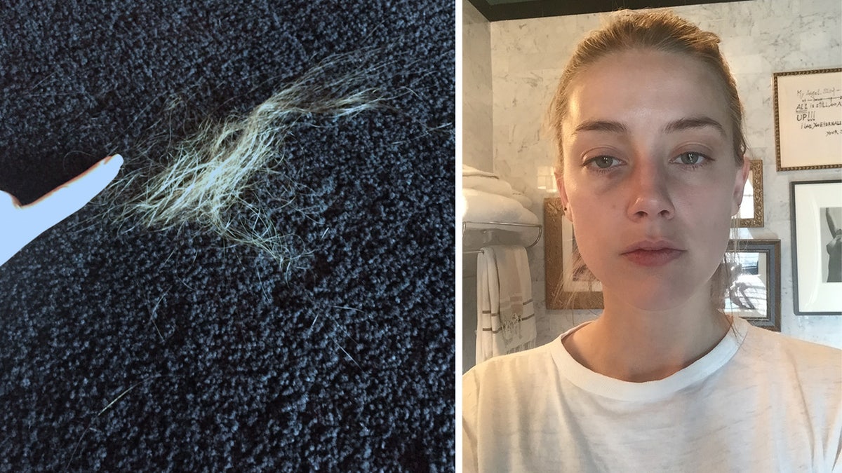 Amber Heard evidence photos of injuries