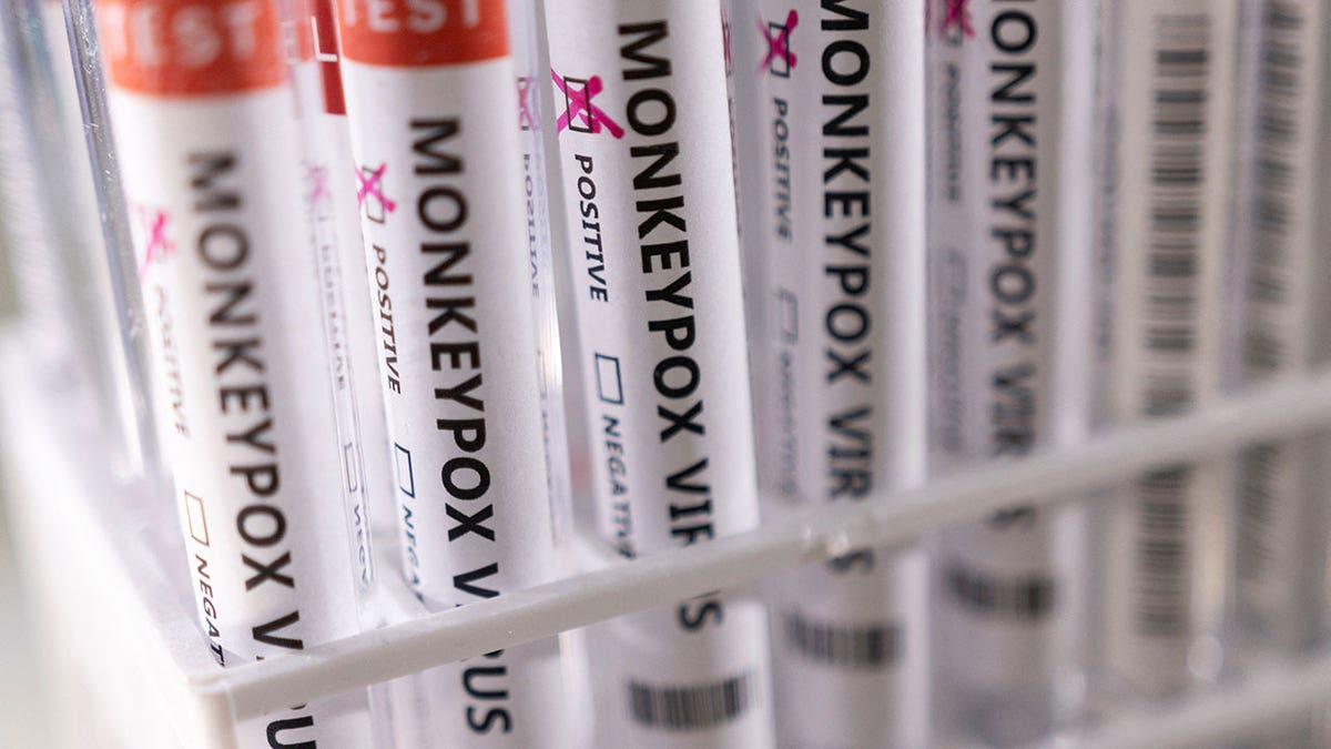 Monkeypox virus test tubes