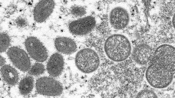 WHO meeting over monkeypox virus spread: report