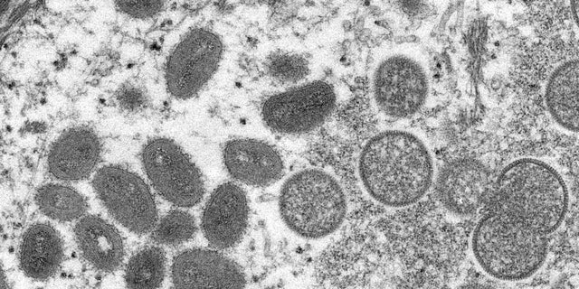 An electron microscopic image shows mature, oval-shaped monkeypox virus particles as well as crescents and spherical particles of immature virions, obtained from a clinical human skin sample in this undated image obtained by Reuters on May 18, 2022.  
