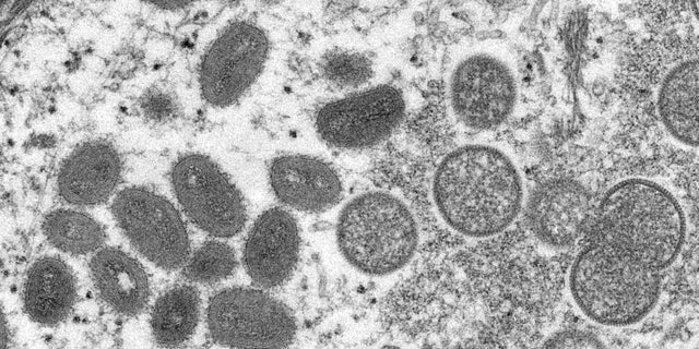 An electron microscopic (EM) image shows mature, oval-shaped monkeypox virus particles as well as crescents and spherical particles of immature virions obtained from a clinical human skin sample associated with the 2003 prairie dog outbreak in this undated image obtained by Reuters May 18, 2022.  