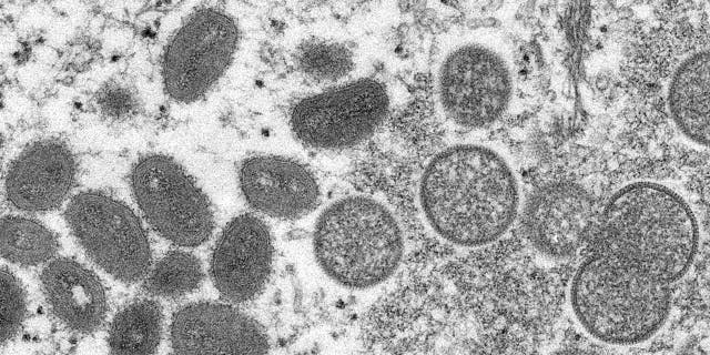 Esta imagen de microscopio electrónico de 2003 proporcionada por los Centros para el Control y la Prevención de Enfermedades muestra viriones maduros de viruela del simio de forma ovalada a la izquierda y viriones esféricos inmaduros a la derecha, obtenidos de una muestra de piel humana asociada con el brote canino de la pradera de 2003. 