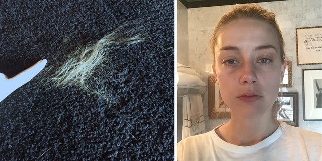 Photos de preuves montrant Amber Heard avec un œil au beurre noir, un nez cassé présumé et une touffe de cheveux sur le sol.