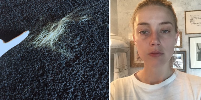 Evidence photos showing Amber Heard with a black eye, an alleged broken nose and a clump of her hair on the floor.