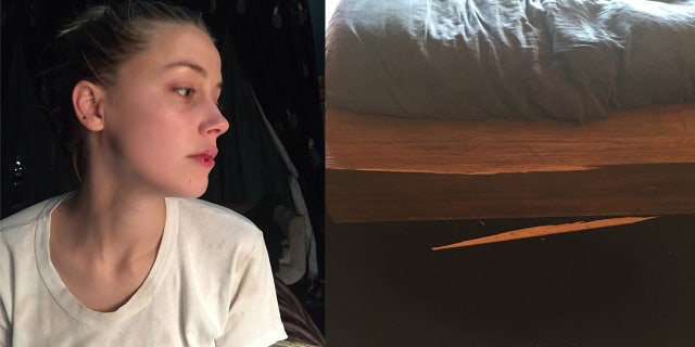 Evidence photos showing Amber Heard with a split lip and a bed with a splintered frame.