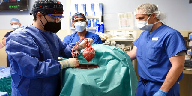 In this photo provided by the University of Maryland School of Medicine, members of the surgical team show the pig heart for transplant into patient David Bennett in Baltimore on Friday, Jan. 7, 2022. 