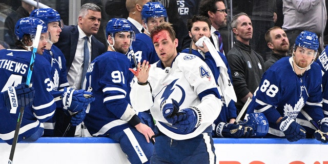 Lightning's Jan Rutta bloodied during fight, Maple Leafs blank Tampa Bay in  Game 1 | Fox News