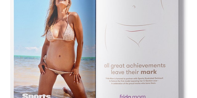 Model Kelly Hughes delivered her now 3-year-old son via cesarean.