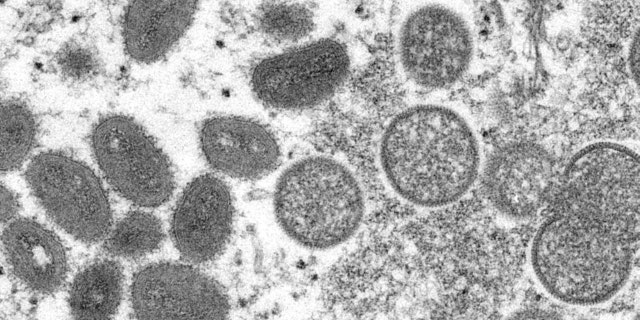 This 2003 electron microscope image made available by the Centers for Disease Control and Prevention shows mature, oval-shaped monkeypox virions, left, and spherical immature virions, right, obtained from a sample of human skin associated with the 2003 prairie dog outbreak.