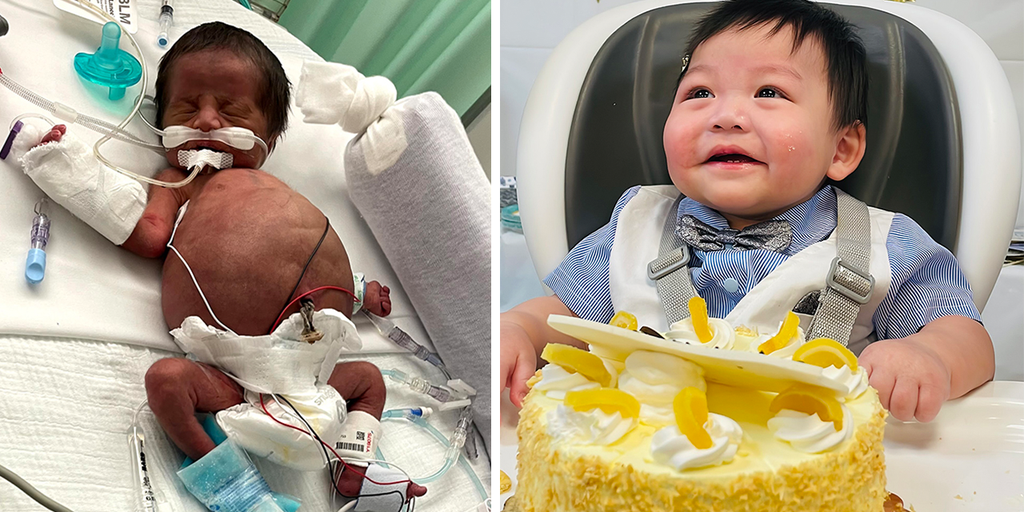 Illinois baby dubbed 'mayor of the NICU' released from hospital before first birthday - Vimarsana News