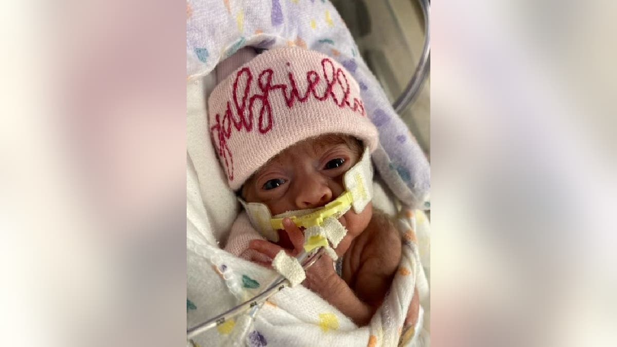 Baby girl Gabriella Grace Hernandez is pictured wearing a pink hat while connected to a CPAP machine, which helps her breath.