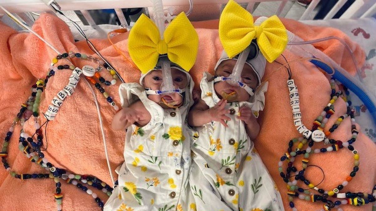 Gabby and Bella are shown lying down in while and yellow floral dresses and yellow bows around their head. Beaded chains spell out their names.