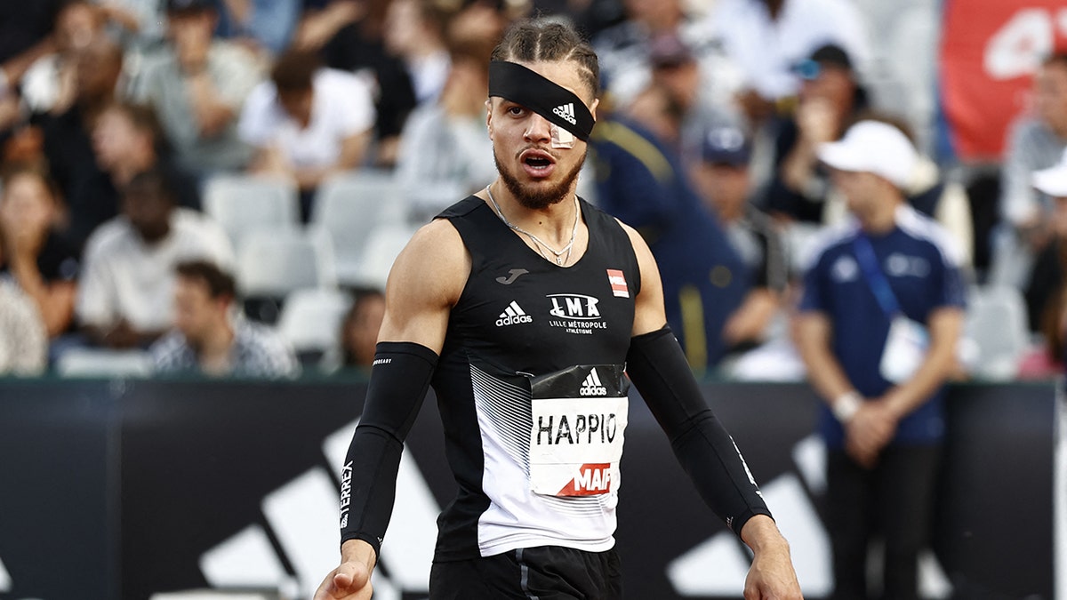 Wilfried Happio wears an eye bandage