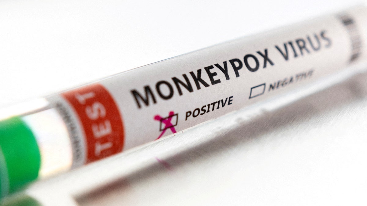 monkeypox virus case