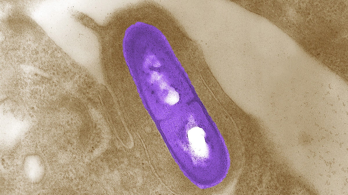 Listeria germ under micrograph