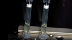 Biden admin boosts testing for monkeypox