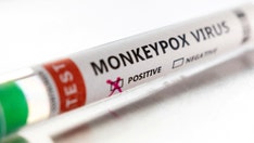 Monkeypox mutating more than previously thought, researchers say
