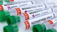 French health body indicates at-risk groups to be vaccinated against monkeypox