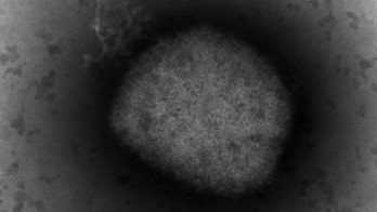 Georgia reports first case of monkeypox virus