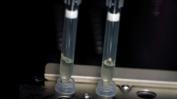 Biden admin boosts testing for monkeypox