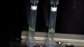 New York monkeypox cases up to 4