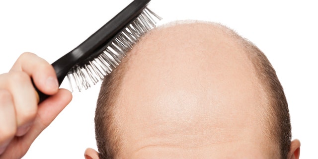 Cure for baldness could be on horizon as Japanese researchers generate mature hair follicles in lab | Fox News Cure for baldness could be on horizon as Japanese researchers generate mature hair follicles in lab | Fox News