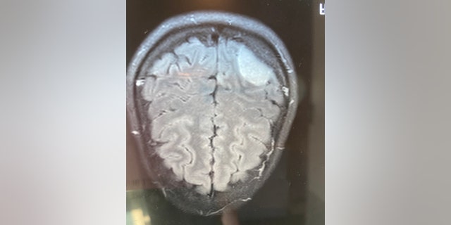 In 2007, Cristina Baker learned she had a brain tumor.
