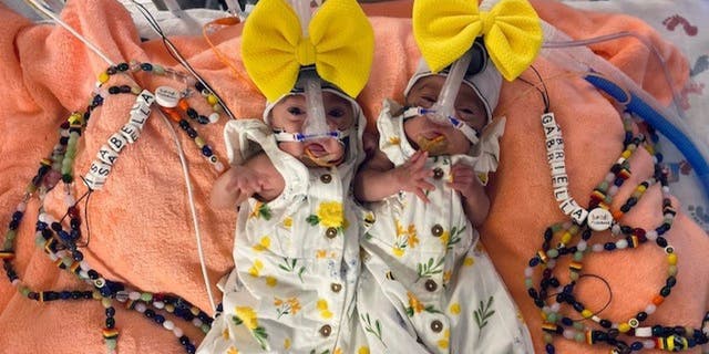Gabriella "Gabby" Grace Hernandez and Isabella "Bella" Rose Hernandez are identical twins from Texas who were born three days apart in March 2022, at Hendrick Health.