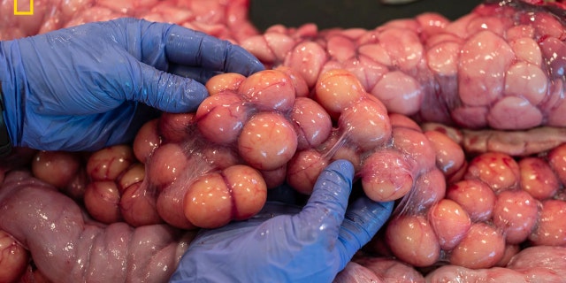 Researcher Ian Bartoszek sifts through dozens of proto eggs while performing a necropsy on the largest female Burmese python ever discovered in Florida. The team counted 122 of these "follicles," another record-breaking tally. 