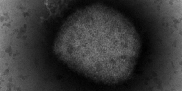 This photo, taken by Unidad de Microscopia Electronica del ISCIII in Madrid on Thursday, May 26, 2022, shows an electronic microscope showing the monkey box virus.