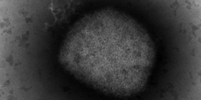 На цьому зображенні, наданому Unidad de Microscopía Electrónica del ISCIII в Мадриді, у четвер, 26 травня 2022 р., зображено на електронному мікроскопі вірус віспи мавп.