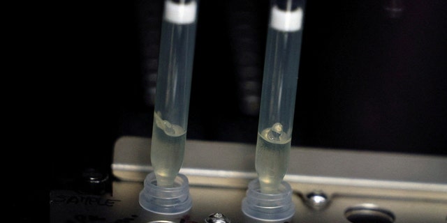FILE PHOTO: Two samples of suspected cases of monkeypox go through a process of nucleic acid extraction as they get tested at a microbiology lab at La Paz Hospital in Madrid, Spain, June 1, 2022. 