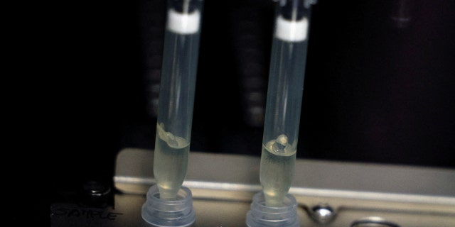 FILE PHOTO: Two samples of suspected cases of monkeypox go through a process of nucleic acid extraction as they get tested at a microbiology lab at La Paz Hospital in Madrid, Spain, June 1, 2022.