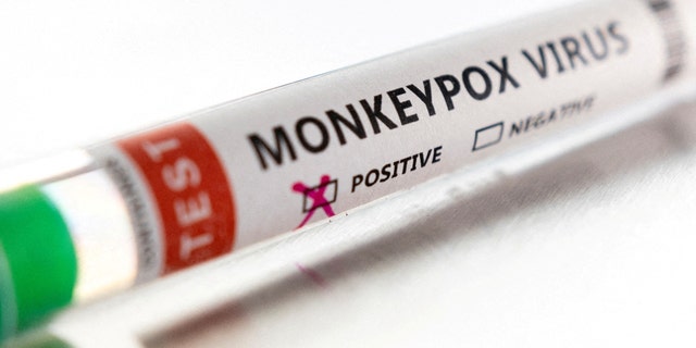 Labeled test tube "Monkeypox virus positive" seen in this illustration taken May 22, 2022. 