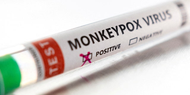 Test tube labeled "Monkeypox virus positive" is seen in this illustration taken May 22, 2022. 