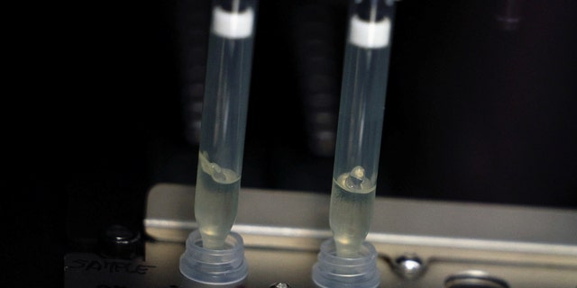 Deux échantillons de cas suspects de monkeypox subissent un processus d'extraction d'acide nucléique lorsqu'ils sont testés dans un laboratoire de microbiologie de l'hôpital de La Paz à Madrid, en Espagne, le 1er juin 2022. 