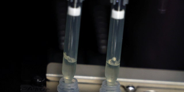 Two samples of suspected cases of monkeypox go through a process of nucleic acid extraction as they get tested at a microbiology lab at La Paz Hospital in Madrid, Spain, June 1, 2022.