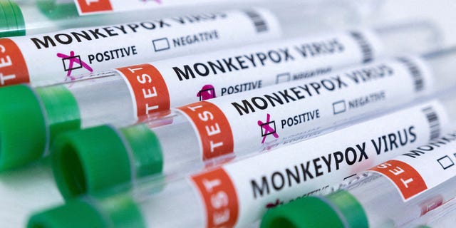 Zkumavky označené "Virus opičích neštovic pozitivní a negativní" jsou vidět na tomto obrázku pořízeném 23. května 2022.