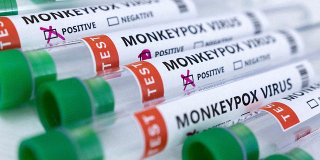 Labeled tubes test "Monkeypox virus positive and negative" are seen in this illustration taken May 23, 2022.