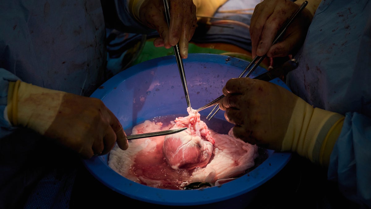 Pig heart
