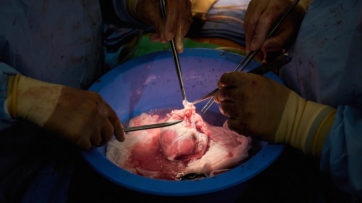 NYU Langone pig heart transplant